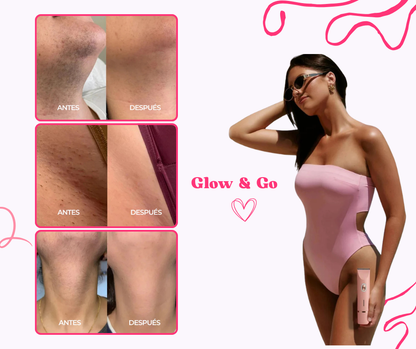 Glow & Go | Depiladora Corporal 2 en 1
