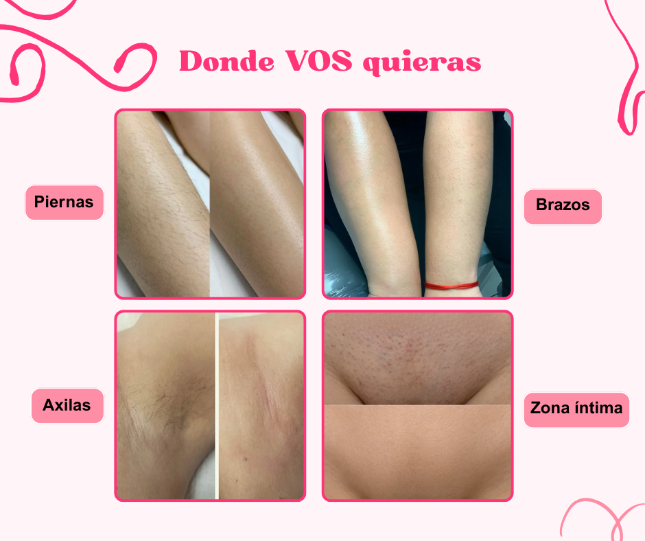 Glow & Go | Depiladora Corporal 2 en 1